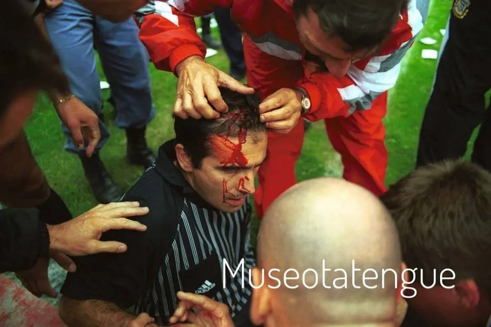 Pese a la pérdida de sangre debido al proyectil lanzado, Barrientos nunca perdió el conocimiento. Gentileza: @museotatengue